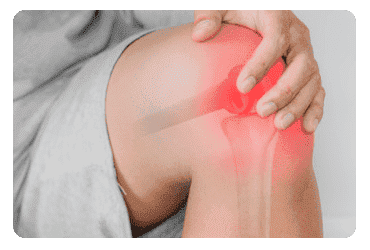 Rodilla