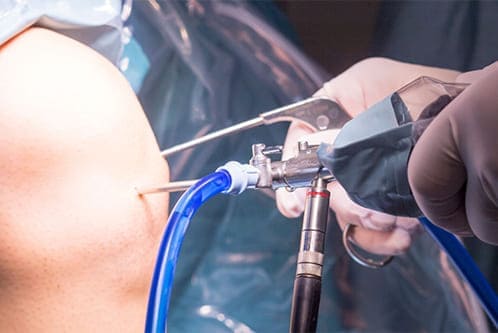 clinica de ortopedia y fracturas