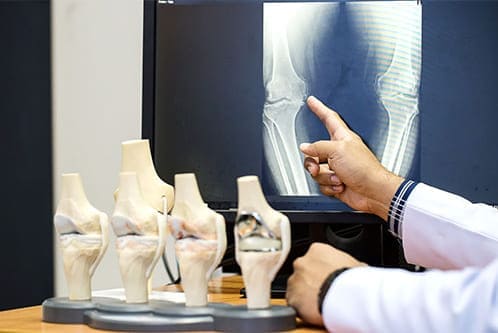 Ortopedista y traumatólogo cerca de Artz Pedregal CDMX